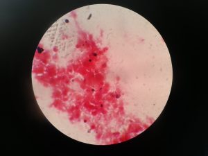 2. Gram stain-Postive conidiospores