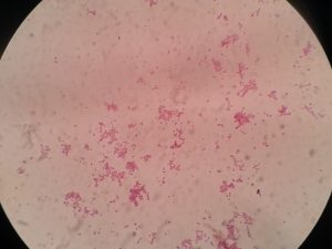 Gram stain from culure