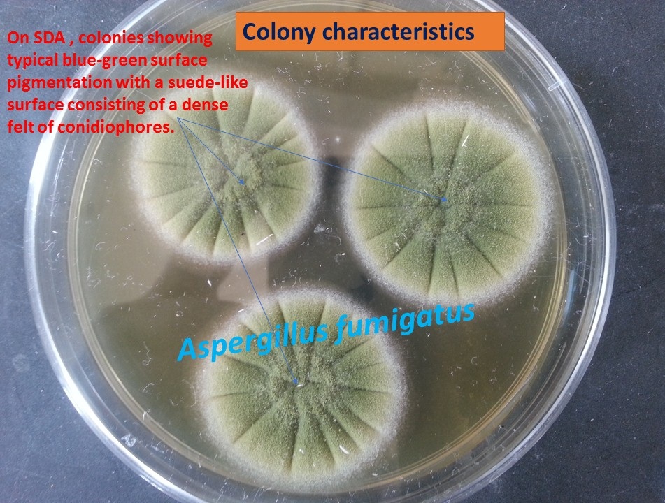 Aspergillus fumigatus colony characteristics