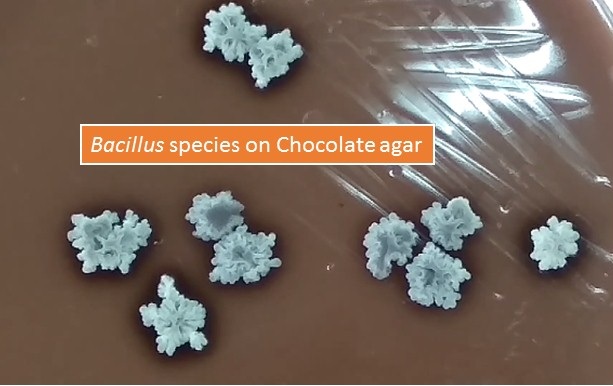 Bacillus species on Chocolate agar