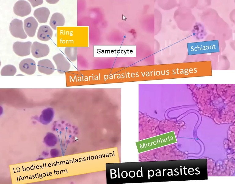 Blood parasites