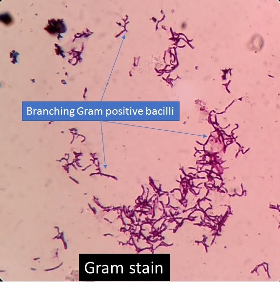Branching gram positive bacilli