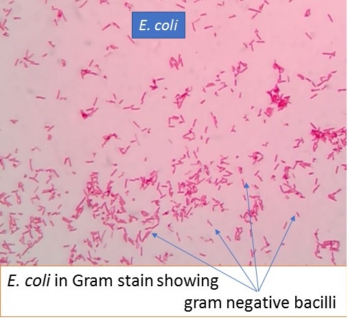 E. coli in gram stain