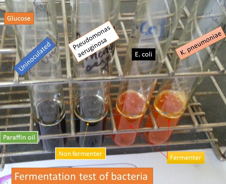 Fermentation test of bacteria