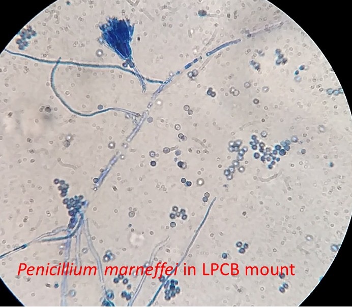 Penicillium marneffei in LPCB mount