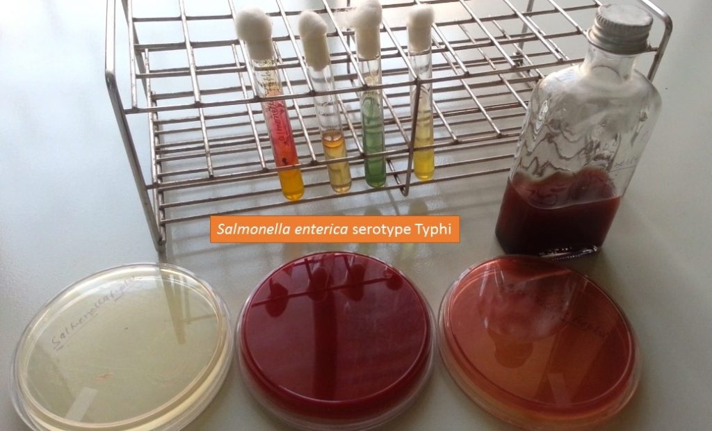 Salmonella Typhi growth on various media and biochemical tests