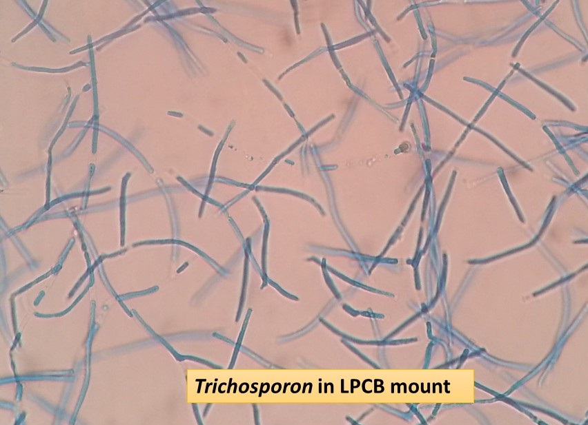 Trichosporon in LPCB