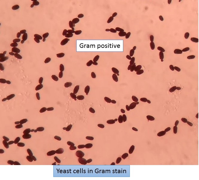 Yeast cells in Gram stain