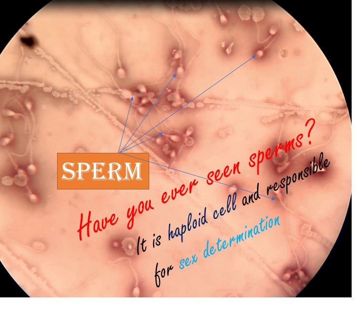sperm viscocity Decreased
