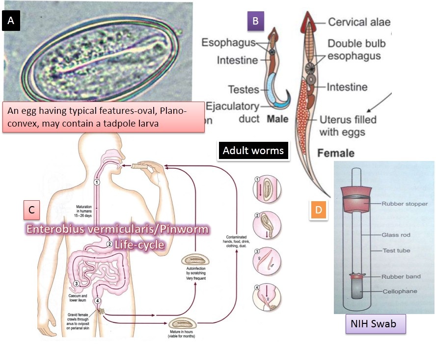 enterobius vermicularis diagram tratamentul paraziților extraintestinali