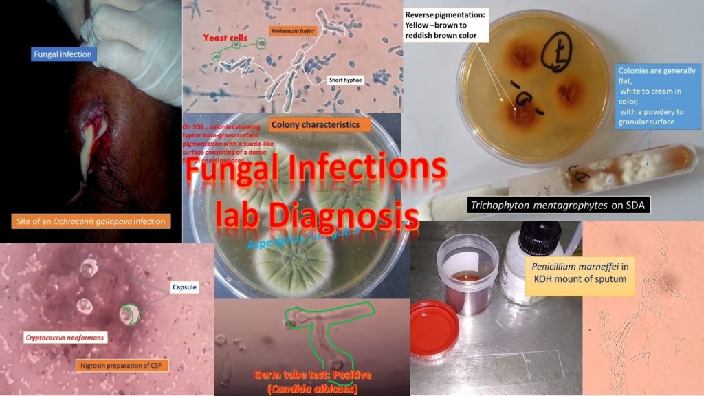 Fungal Infections Laboratory diagnosis: Introduction, sample collections