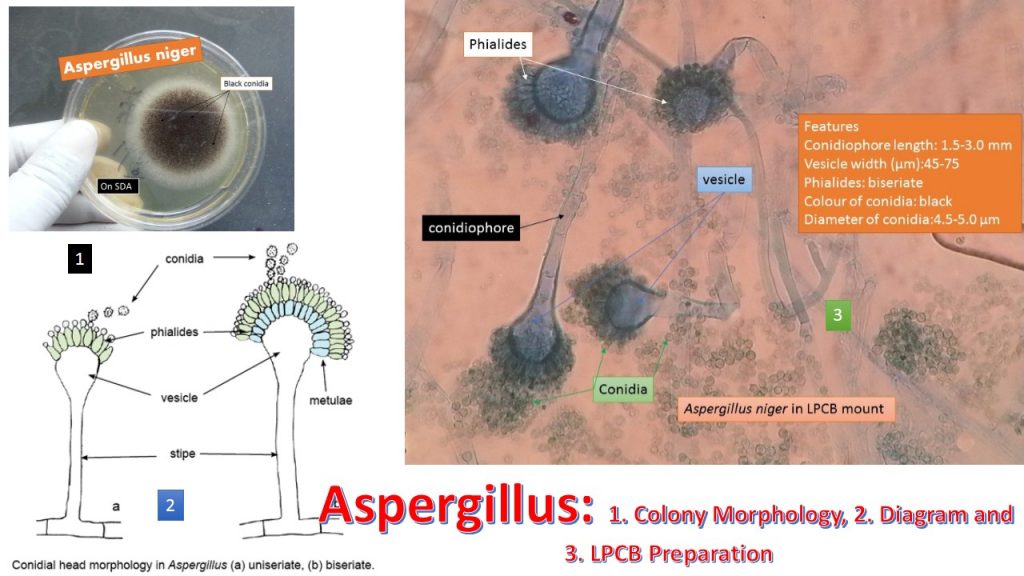 Aspergillus colony morpholoy, diagram and LPCB Preparation
