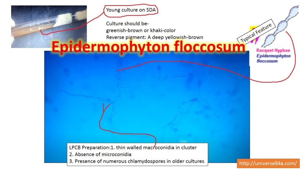 Epidermophyton- General Characteristics, Pathogenesis, Clinical Findings, Laboratory Diagnosis,Treatment , Prevention