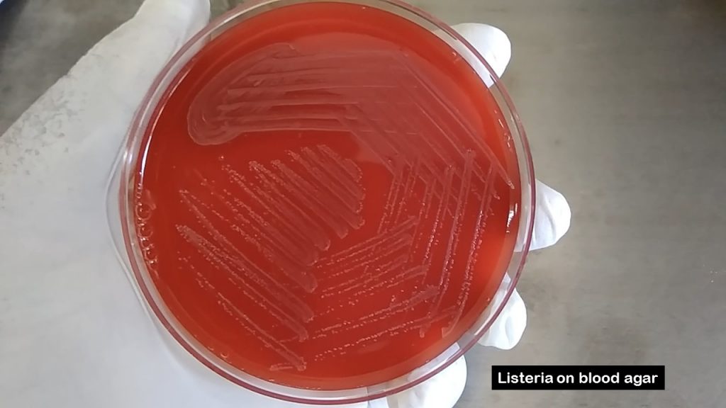 Listeria on blood agar