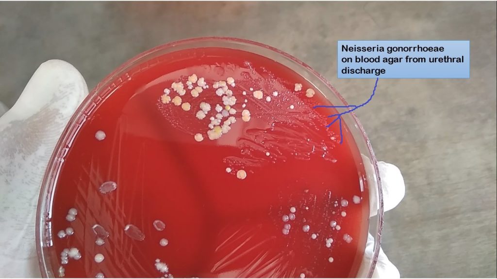 Neisseria gonorrhoeae on blood agar from urethral discharge
