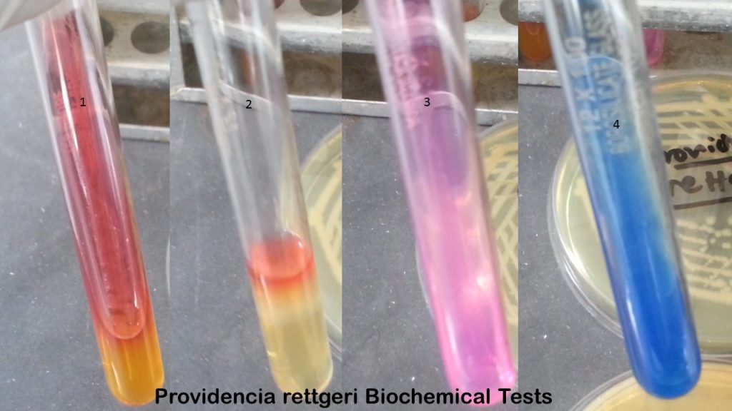 Providencia rettgeri biochemical tests
