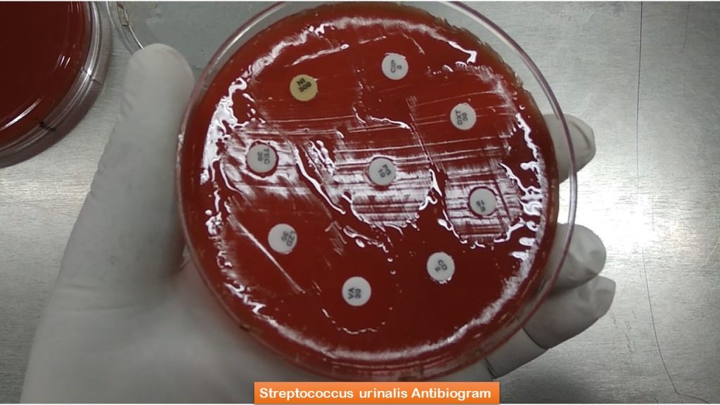 Streptococcus urinalis Antibiogram