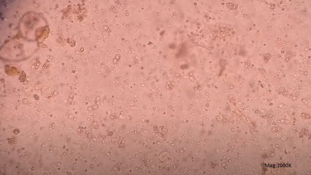 Cysts of Endolimax nana in Saline Wet Mount Microscopy