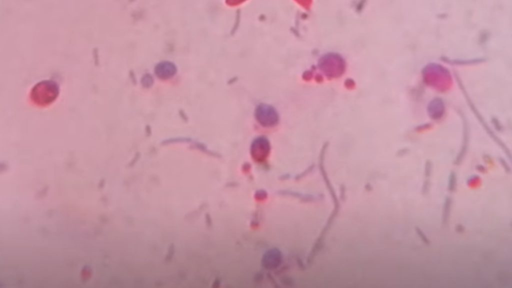 Kinyoun's stained feacal smear Microscopy showing Oocysts of  Cryptospoidium parvum 