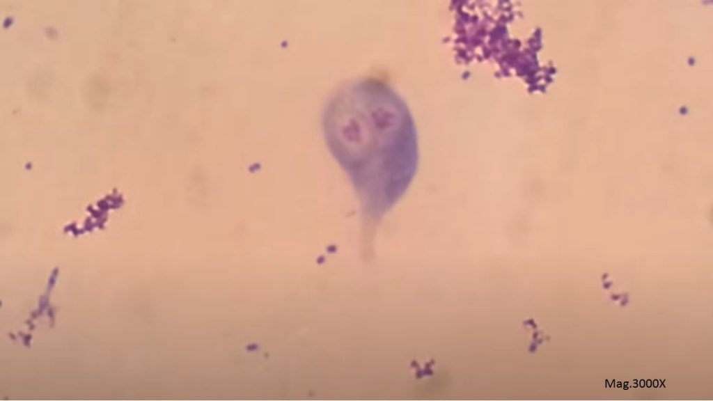 Trichome stained smear of stool Microscopy showing Trophozoite of Giardia lamblia