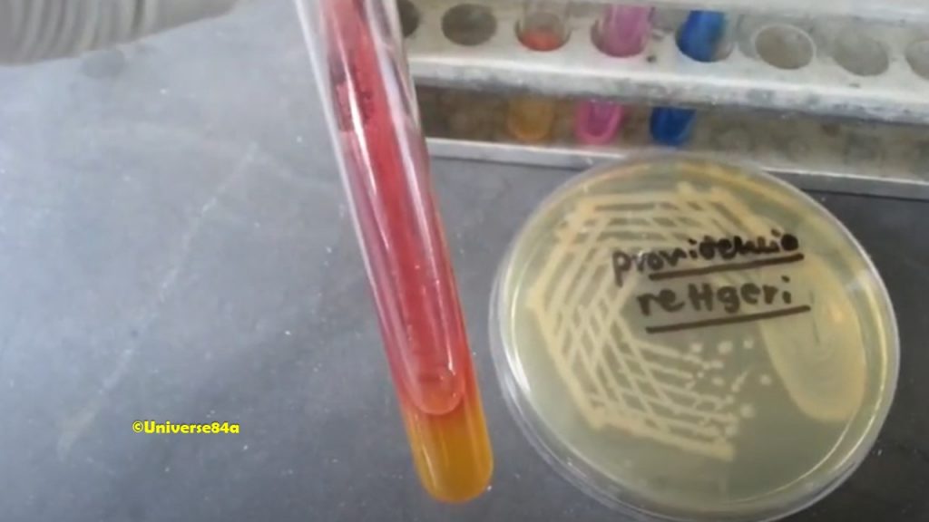 Providencia rettgeri biochemical tests