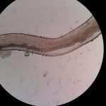 Microfilaria of eye specimen