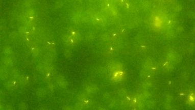 Mycobacterium under Fluorescence microscope pictures of auramine-phenol stained slide under fluorescence microscopy having following features- Bright yellow rods, variable in length, often curved or also fragmented, glowing against a background.