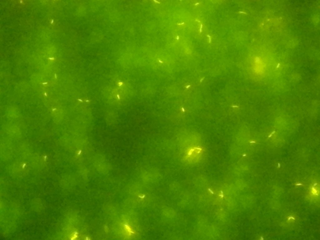 Mycobacterium under Fluorescence microscope