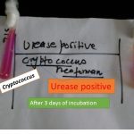 Urease positive fungi