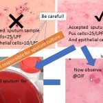 Gram stain indicating Ideal sputum i.e Sputum Specimen quality determination prior to culturing: Introduction and rejection criteria