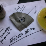Oxidase test