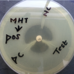 Modified Hodge test Positive