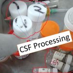 CSF analysis