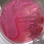 E. coli on MacConkey agar enterobacteriaceae