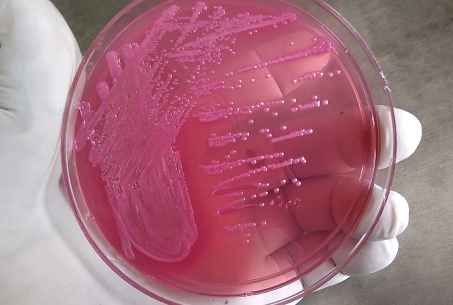 E. coli on MacConkey agar enterobacteriaceae
