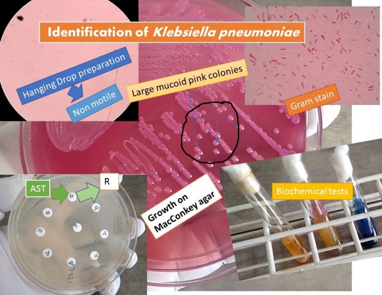Confirmatory Test For Klebsiella Pneumoniae At Gabriella Raiwala Blog