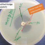 Modified Hodge Test Negative Control Positive Control Test