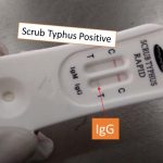 Scrub rapid test positive