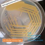Sphingobacterium mizutaii on MHA Yellow pigment No growth on MAC oxidase positive Cotrimoxazole and pefloxacin -Sensitive Gentamycin , amikacin and ploymyxin -Resistant