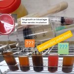 Anaerobic Infection: Importance, Indications, List of Anaerobic Bacteria