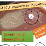 Use of bacitracin 10U for haemophilus screening