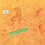 ycobacterium leprae on Modified Ziehl-Neelsen stain