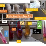 TSI Test: Introduction, Principle, Procedure, Result-Interpretation and Limitation