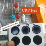 CRP test