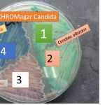 Chromagar Candida