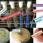 Citrate Utilization Test