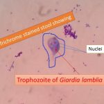 Giardia