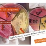 Mannitol salt agar (MSA)