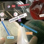 Oxidase test