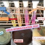 urease test